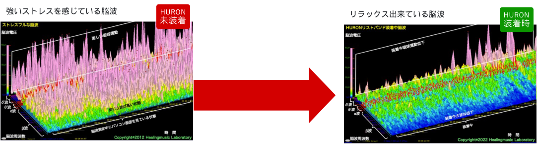 「【HURON未装着】強いストレスを感じている脳波」→ HURONを装着すると → 「【HURON装着時】リラックスできている脳波」
